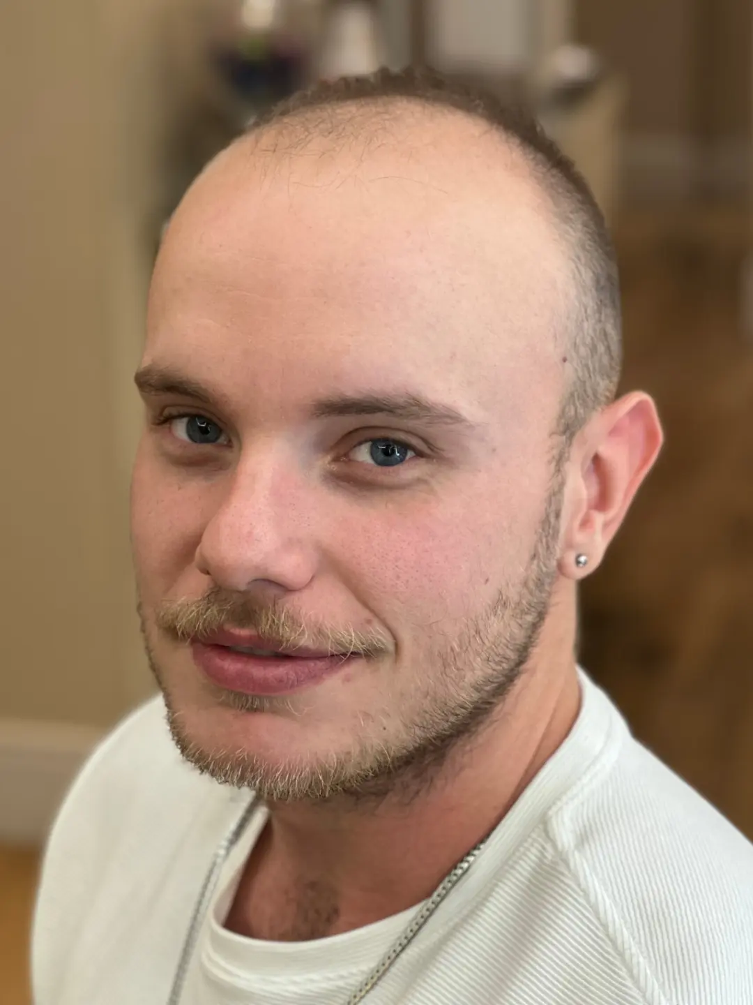 Cliente antes da aplicação da prótese capilar masculina